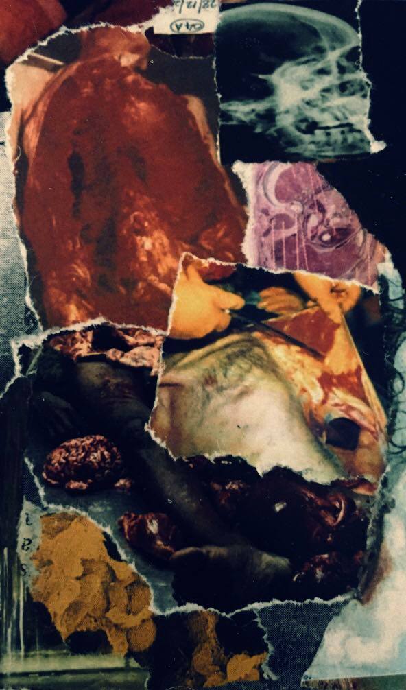 Carbonized Organs - Putrefactio