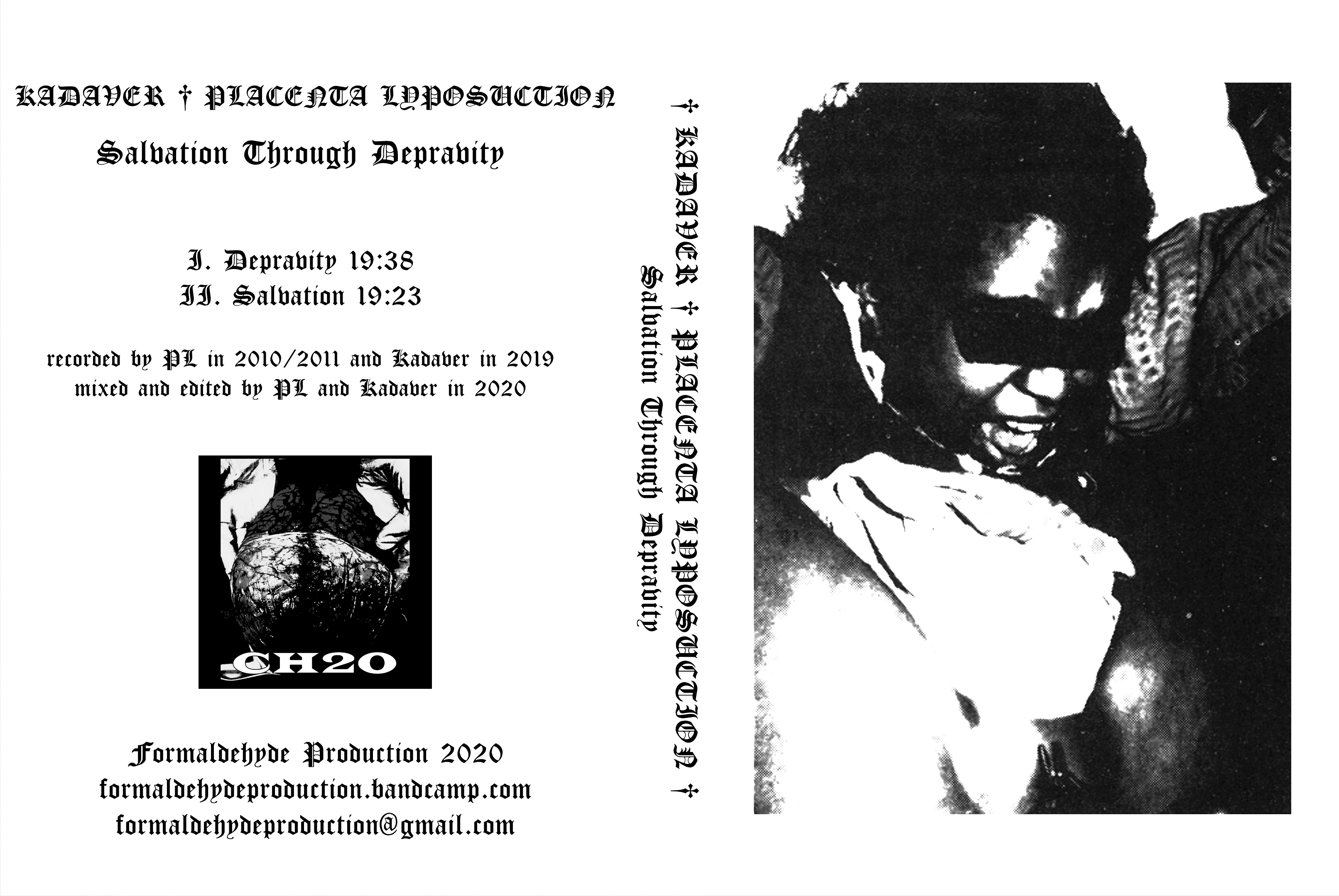 KADAVER + PLACENTA LYPOSUCTION -  Salvation Through Depravity