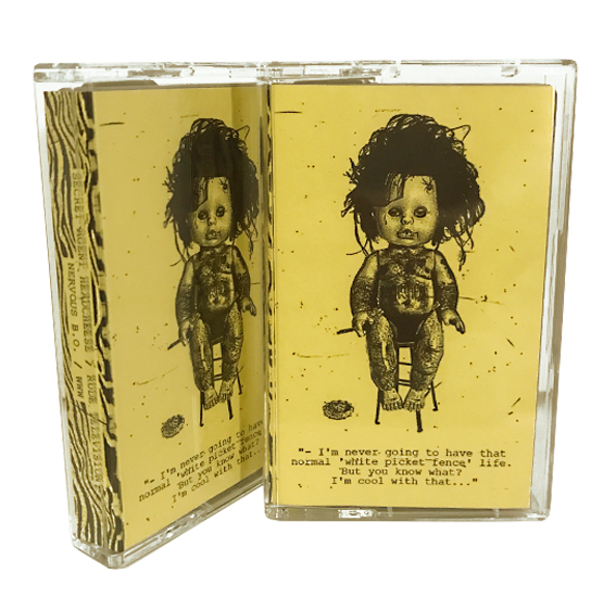 Secret Agent Headcheese / Rude Television / Nervous B.O. / WWW (BLÄ002) Cassette Tape