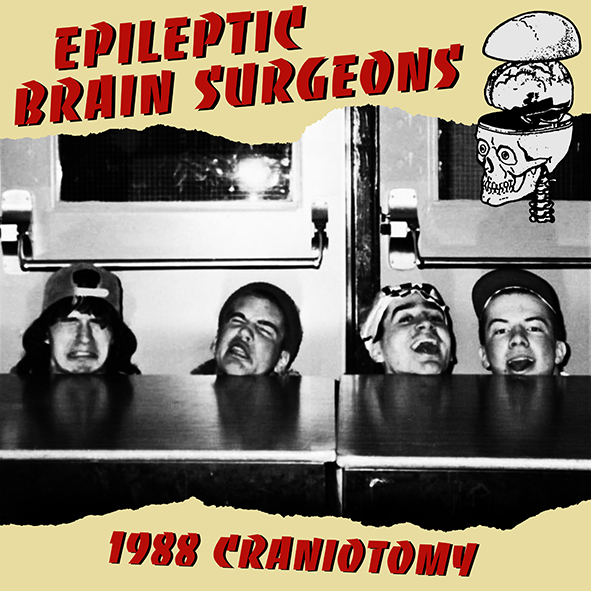 Epileptic Brain Surgeons - 1988 Craniotomy