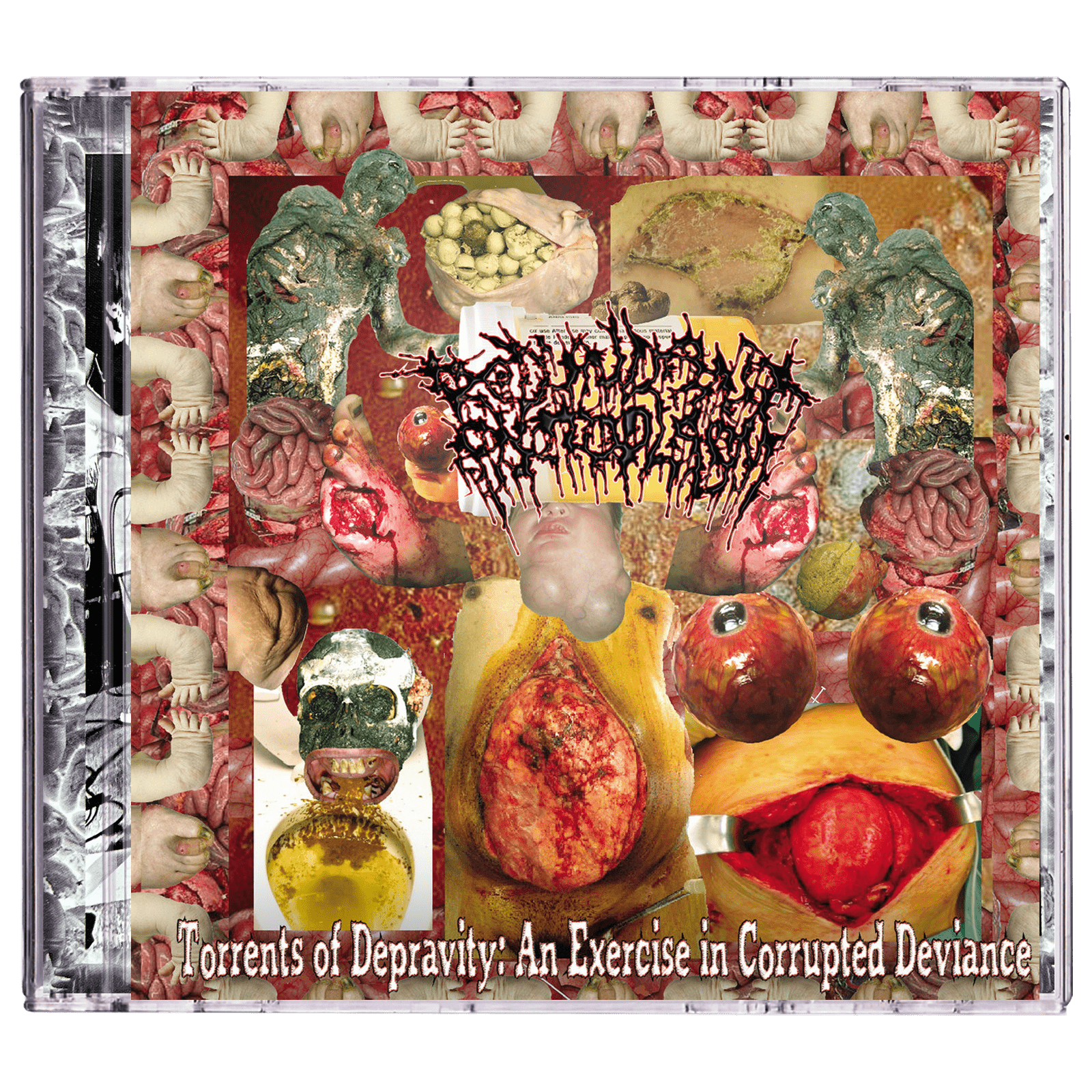 Redundant Protoplasm 'Torrents of Depravity: An Exercise In Corrupted Deviance' CD