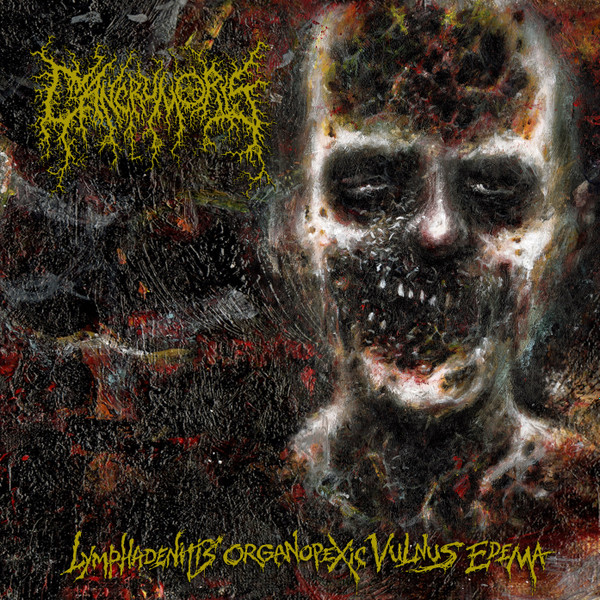 Cancrum Oris - Lymphadenitis Organopexic Vulnus Edema (CD, 2023)