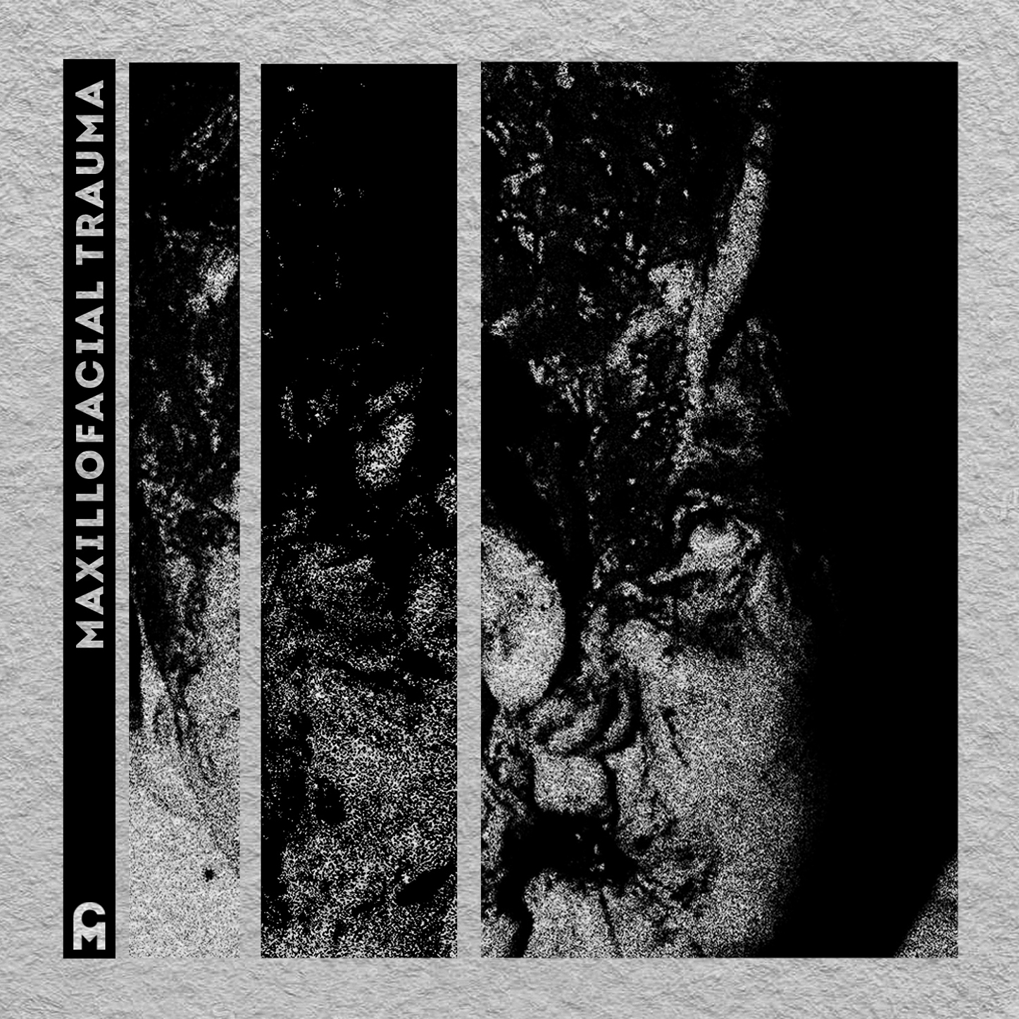 Corpse Mécanique -  Maxillofacial