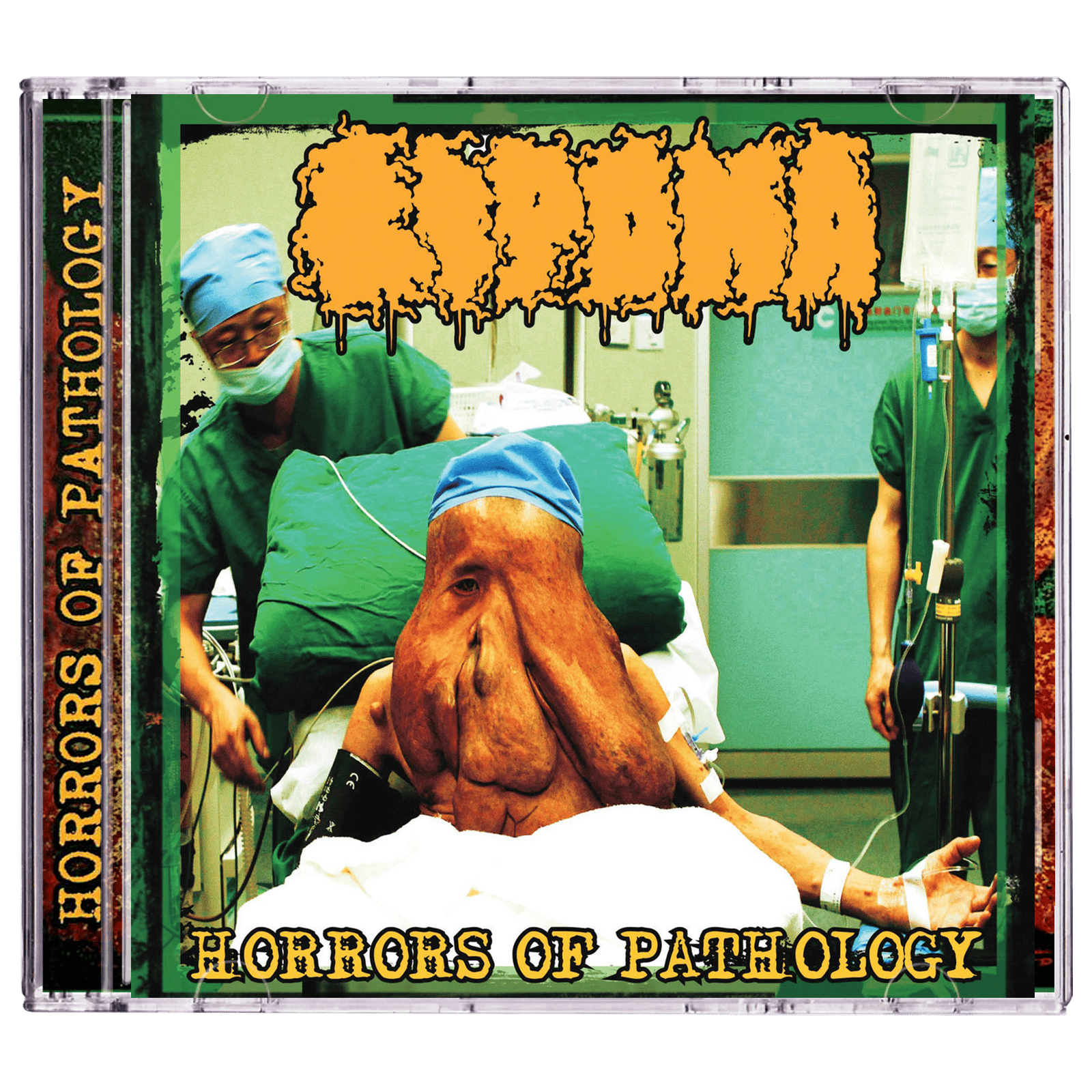 Lipoma 'Horrors Of Pathology' CD