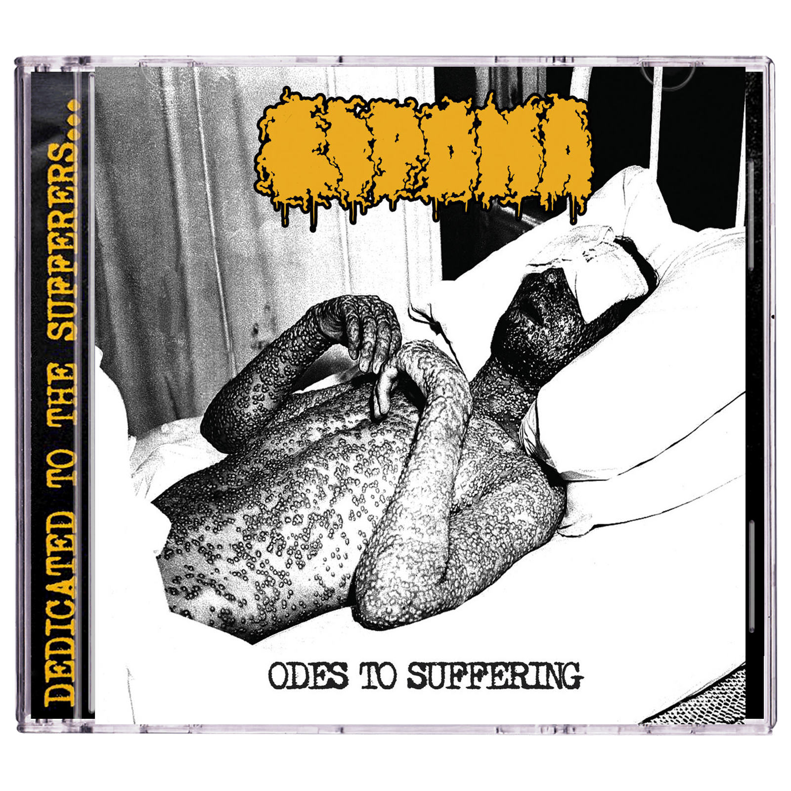 Lipoma 'Odes To Suffering' CD
