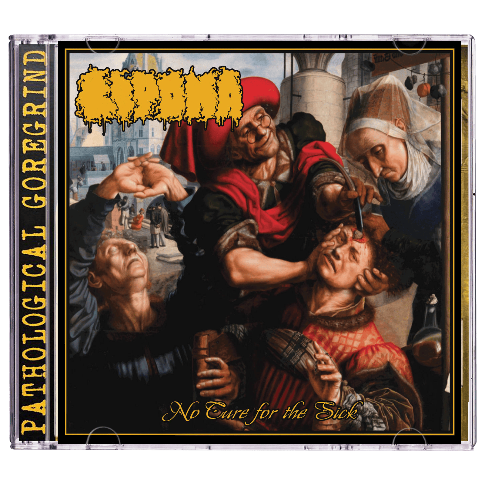 Lipoma 'No Cure For The Sick' CD