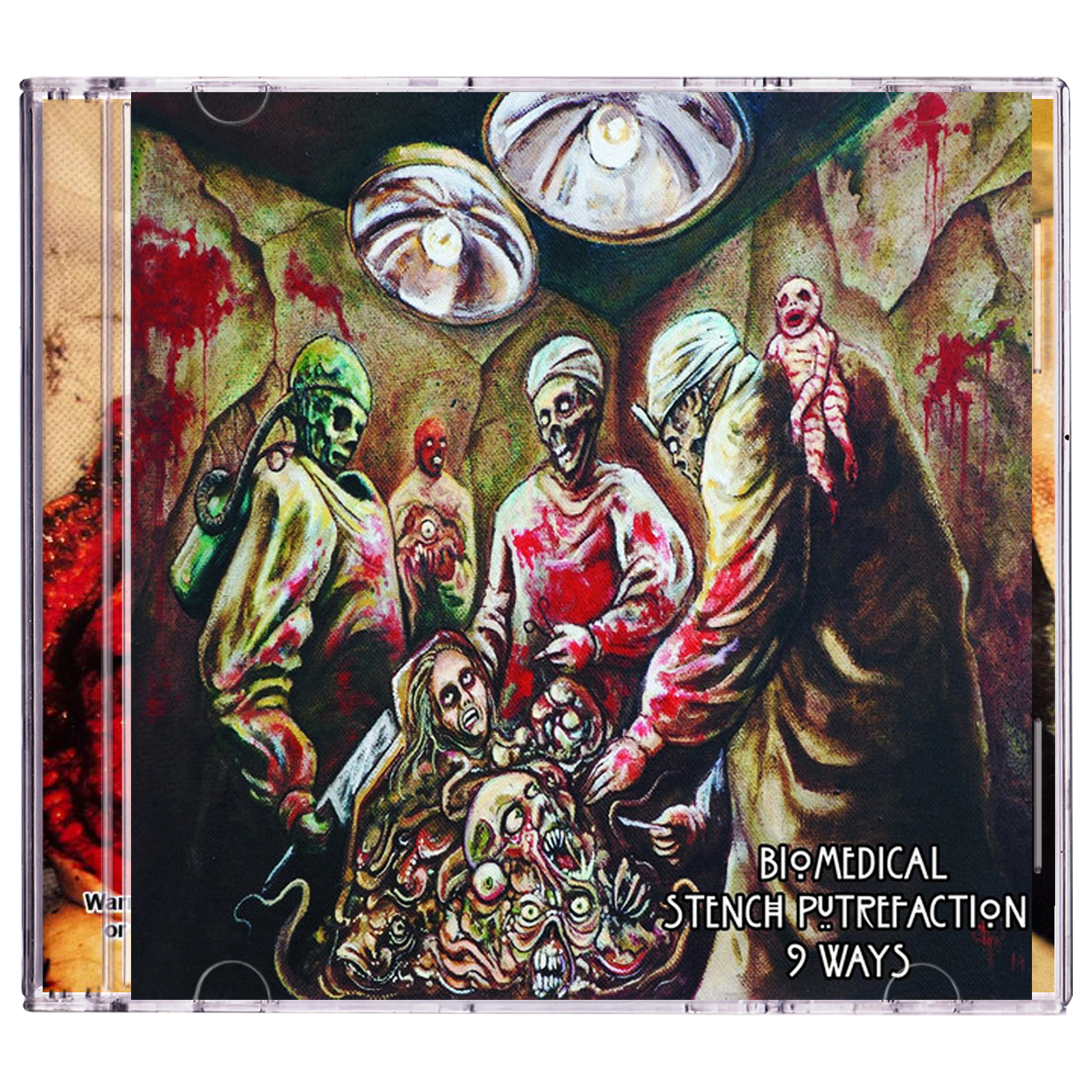 Traumatic Brain Injury / Myxoma / Formicidae / Faeces Eruption / Human Pancake / Golem Of Gore / Serotonin Leakage / Endotoxaemia / Mangled Scum 'Biomedical Stench Of Putrefaction (Split)' CD