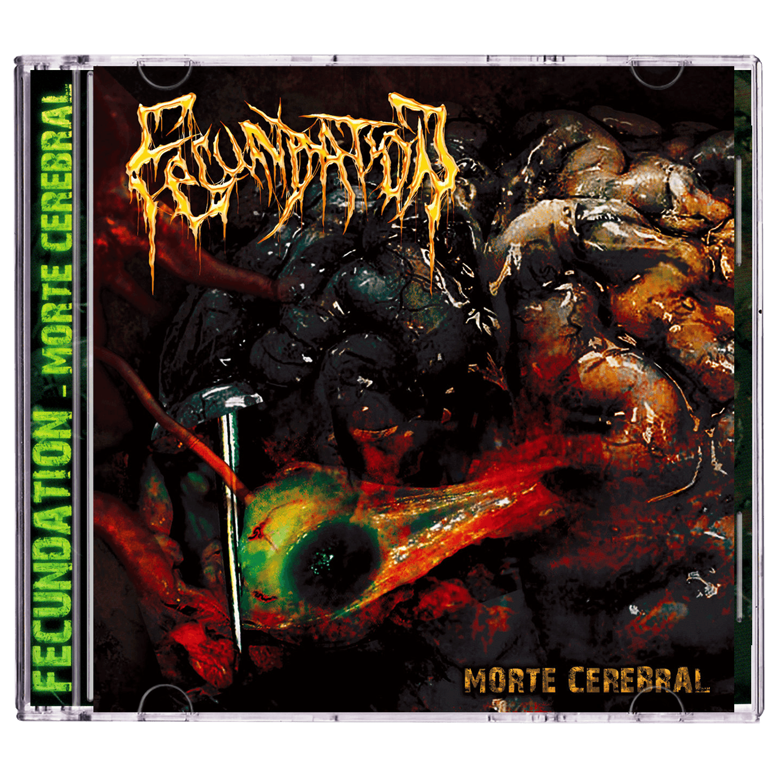 Fecundation 'Morte Cerebral' CD