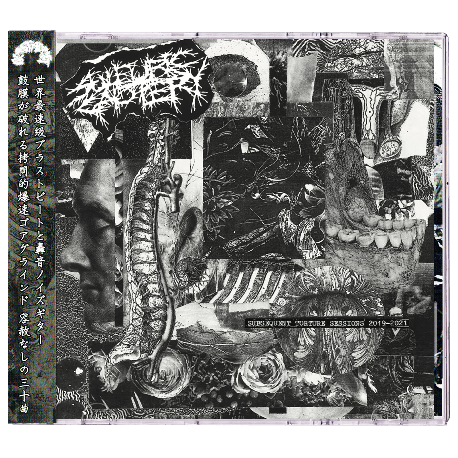Sulfuric Cautery 'Subsequent Torture Sessions 2019-2021' CD
