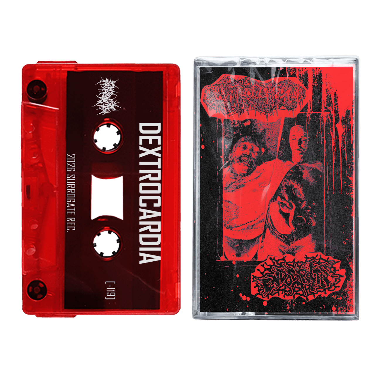 Dextrocardia / Endocarditis 'Split' Cassette