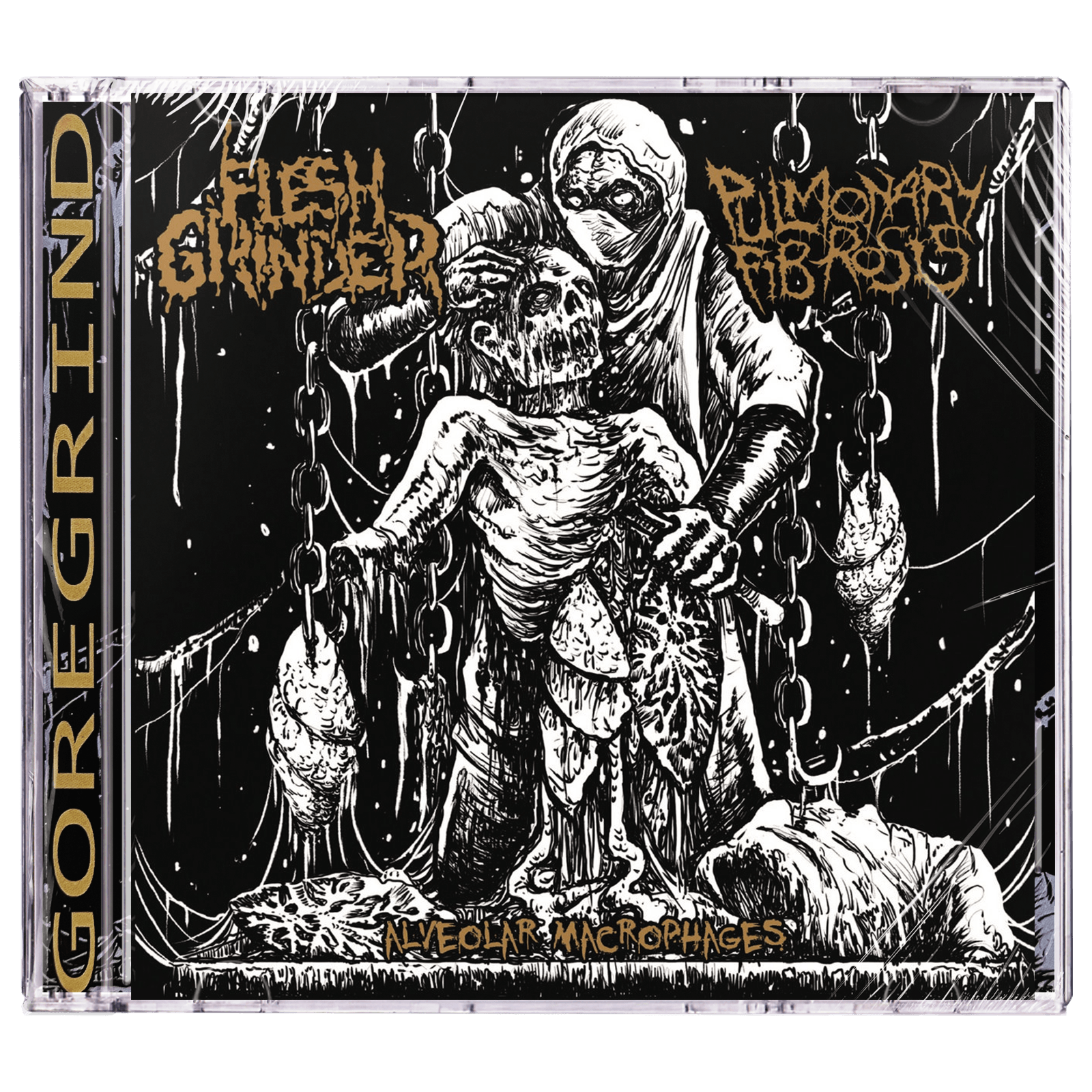 Flesh Grinder / Pulmonary Fibrosis 'Alveolar Macrophages (Split)' CD