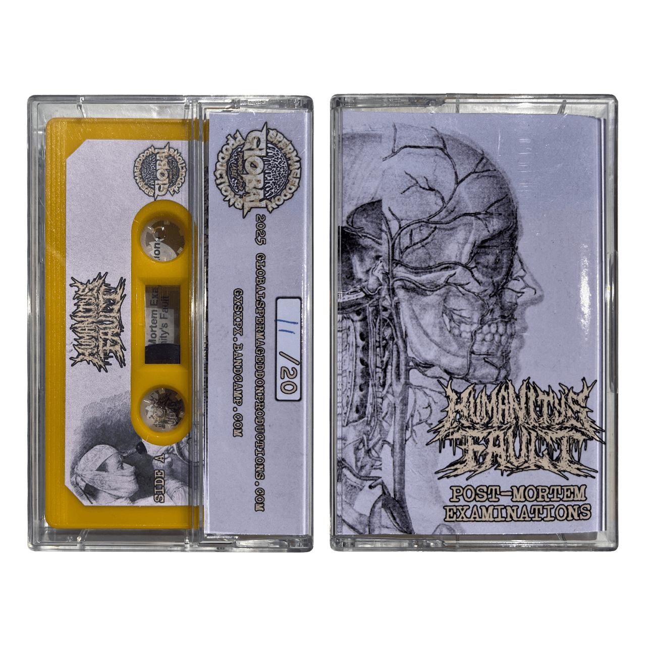 Humanity's Fault 'Post-Mortem Examinations' Cassette