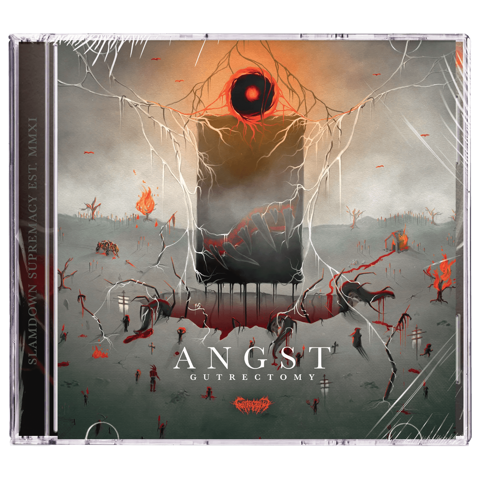 Gutrectomy 'Angst' CD