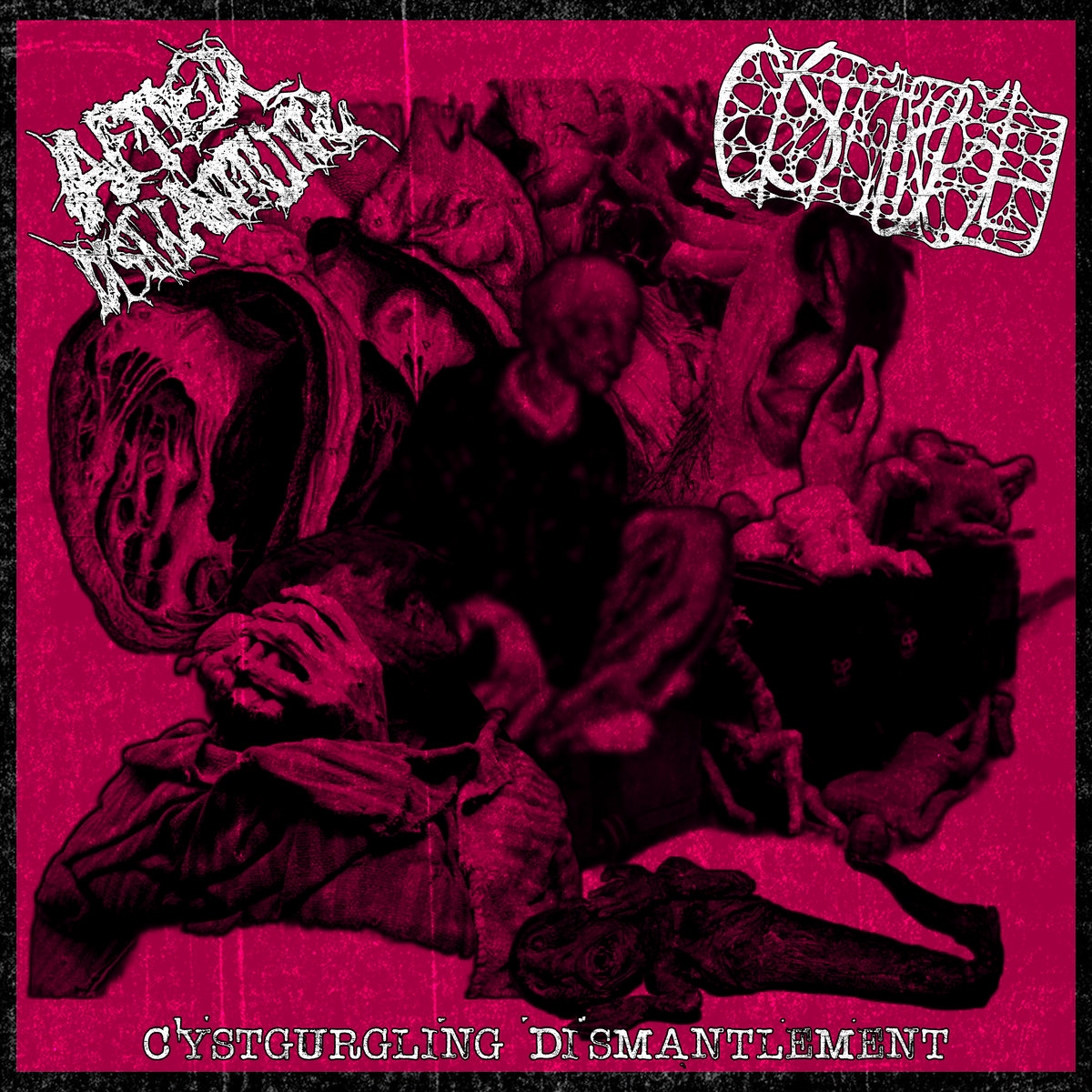 AfterDismantling / Cystgurgle - Cystgurgling Dismantlement (cs, 2026)