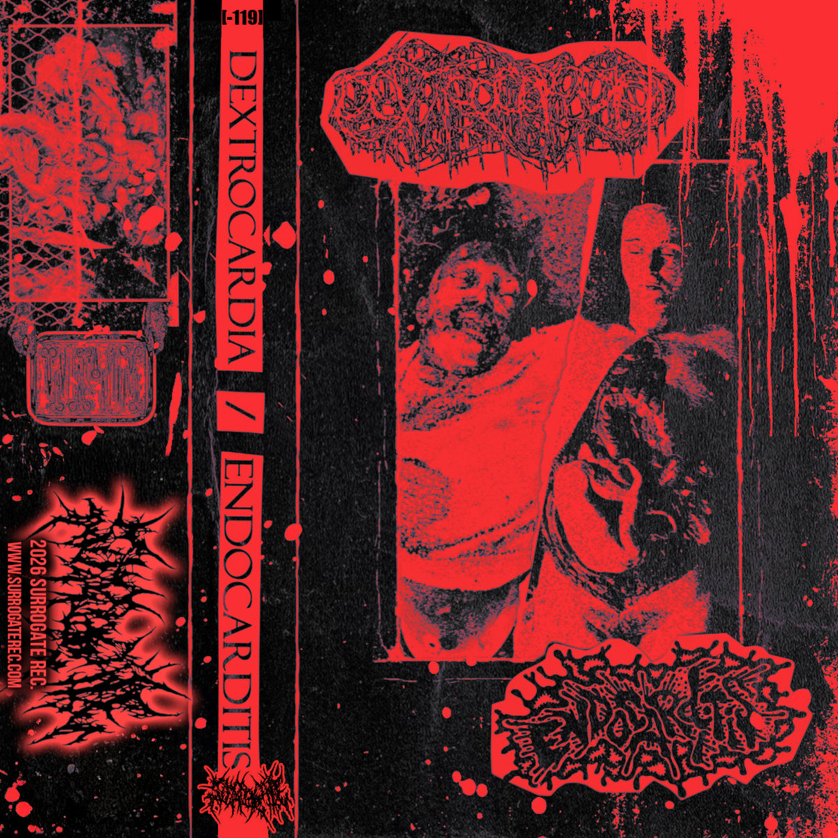 Dextrocardia / Endocarditis - Split (cs, 2026)