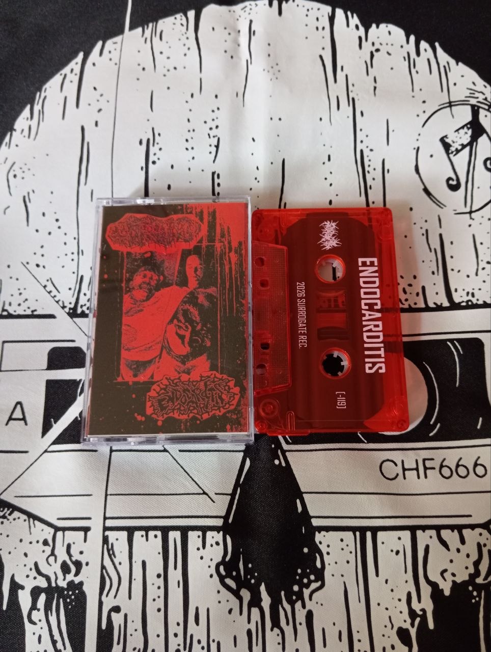 Dextrocardia / Endocarditis - Split (cs, 2026)
