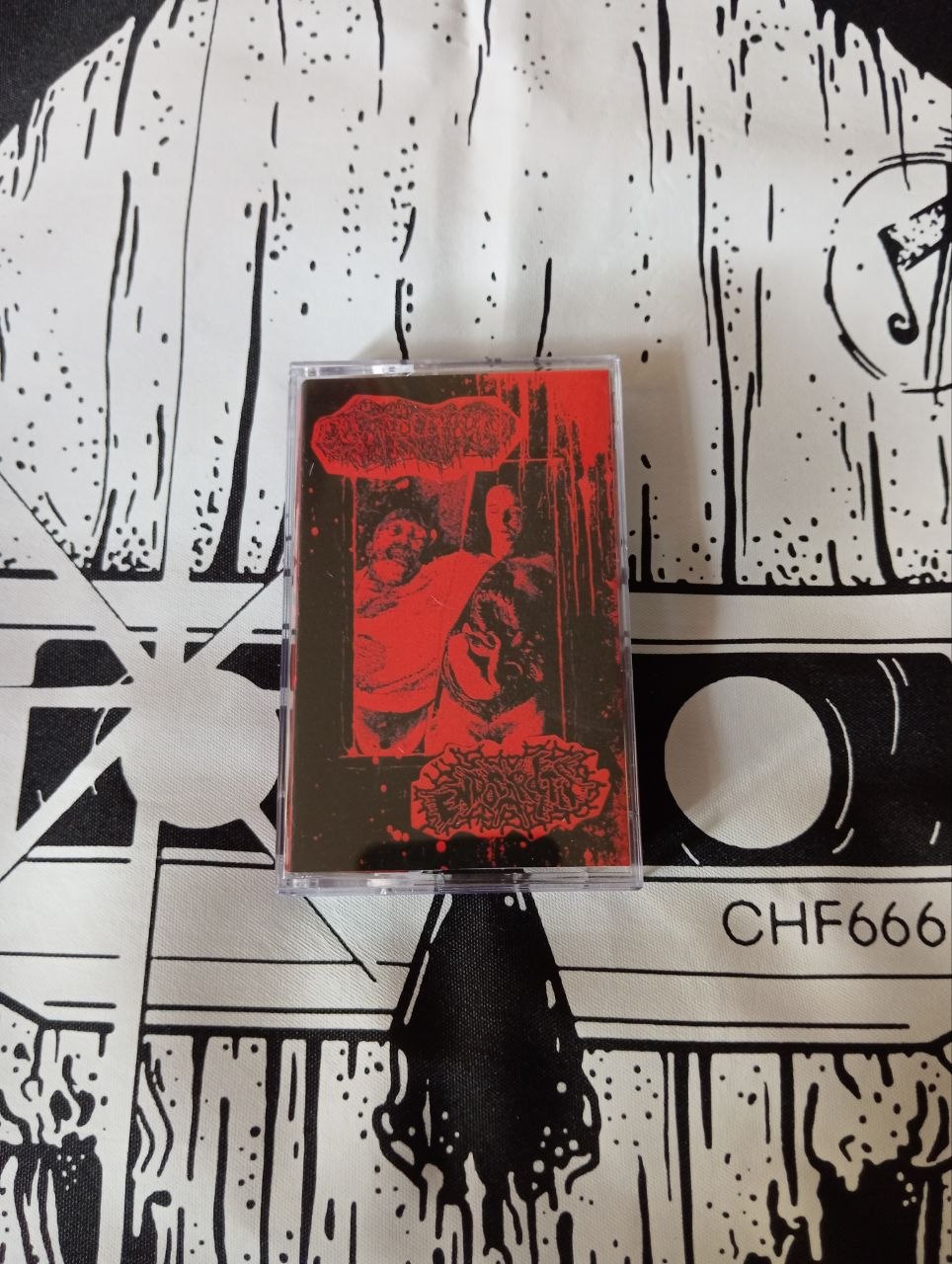 Dextrocardia / Endocarditis - Split (cs, 2026)