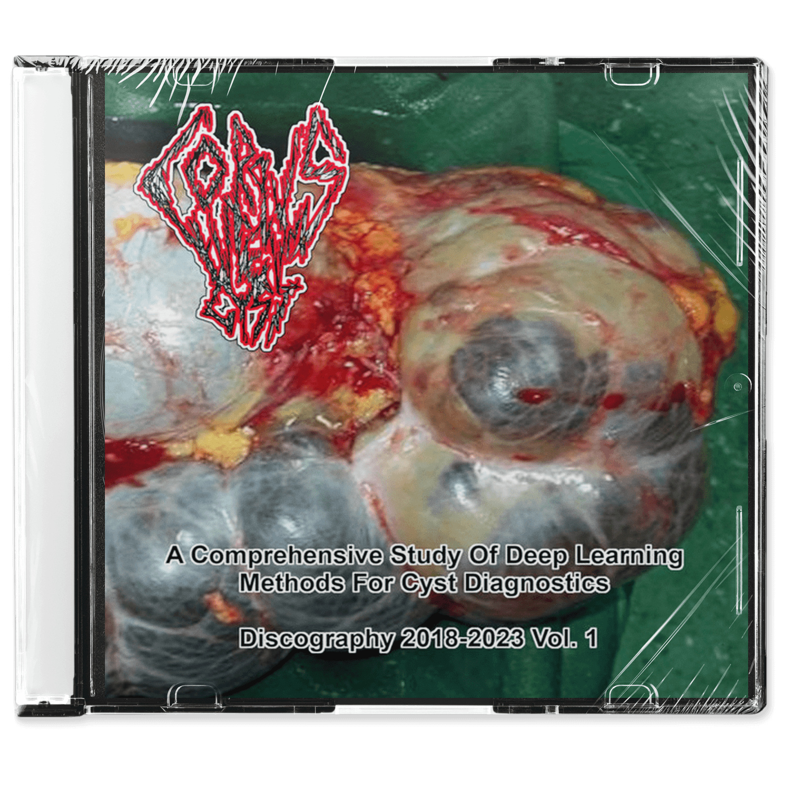 Corpus Luteum Cyst 'A Comprehensive Study Of Deep Learning Methods For Cyst Diagnostic - Vol. 1' CD