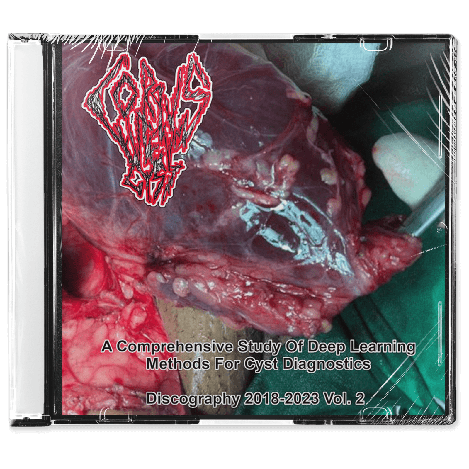 Corpus Luteum Cyst 'A Comprehensive Study Of Deep Learning Methods For Cyst Diagnostic - Vol. 2' CD