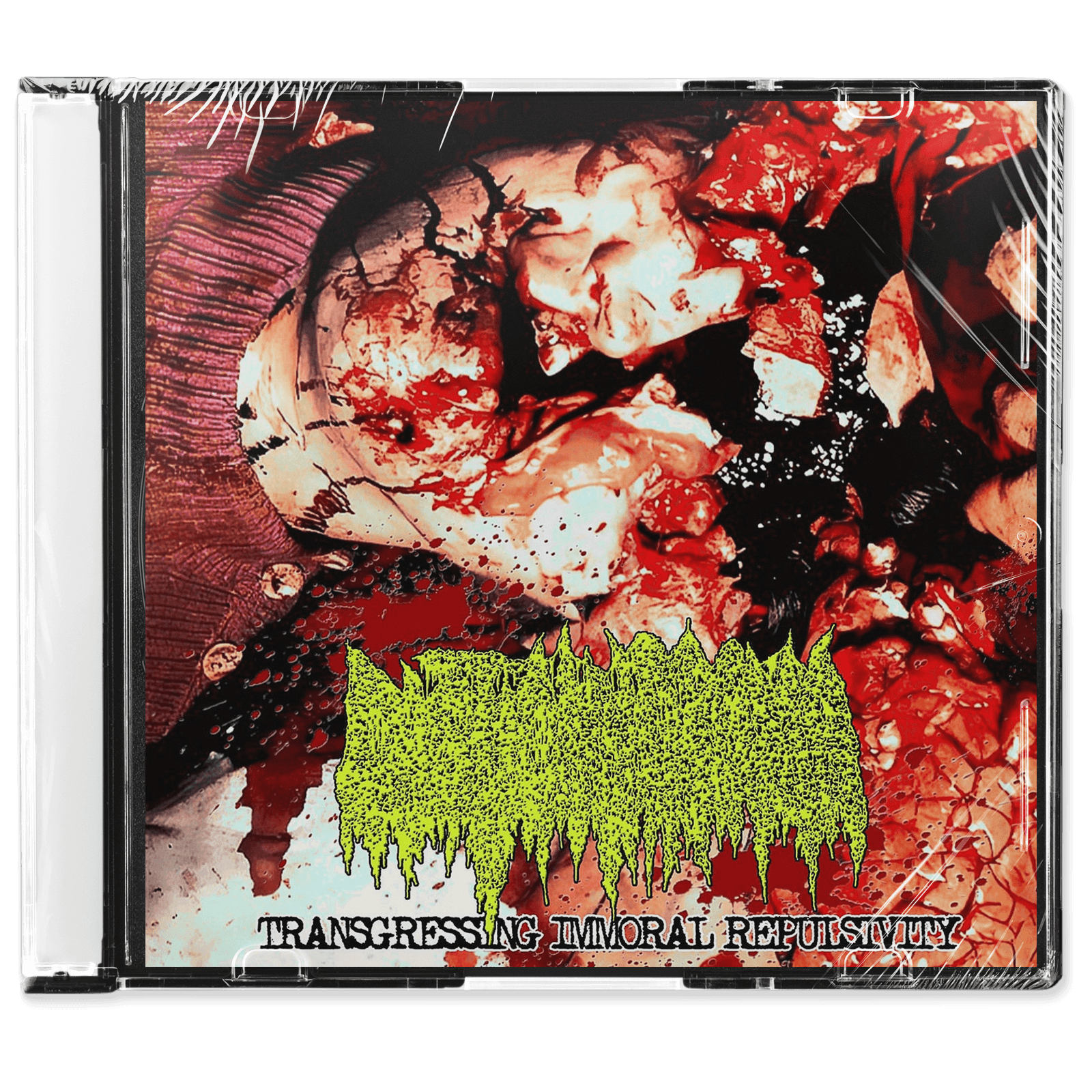 Cystic Hygroma / Bioculus Phlyctaenulosial Scrofulosa 'Split' CD