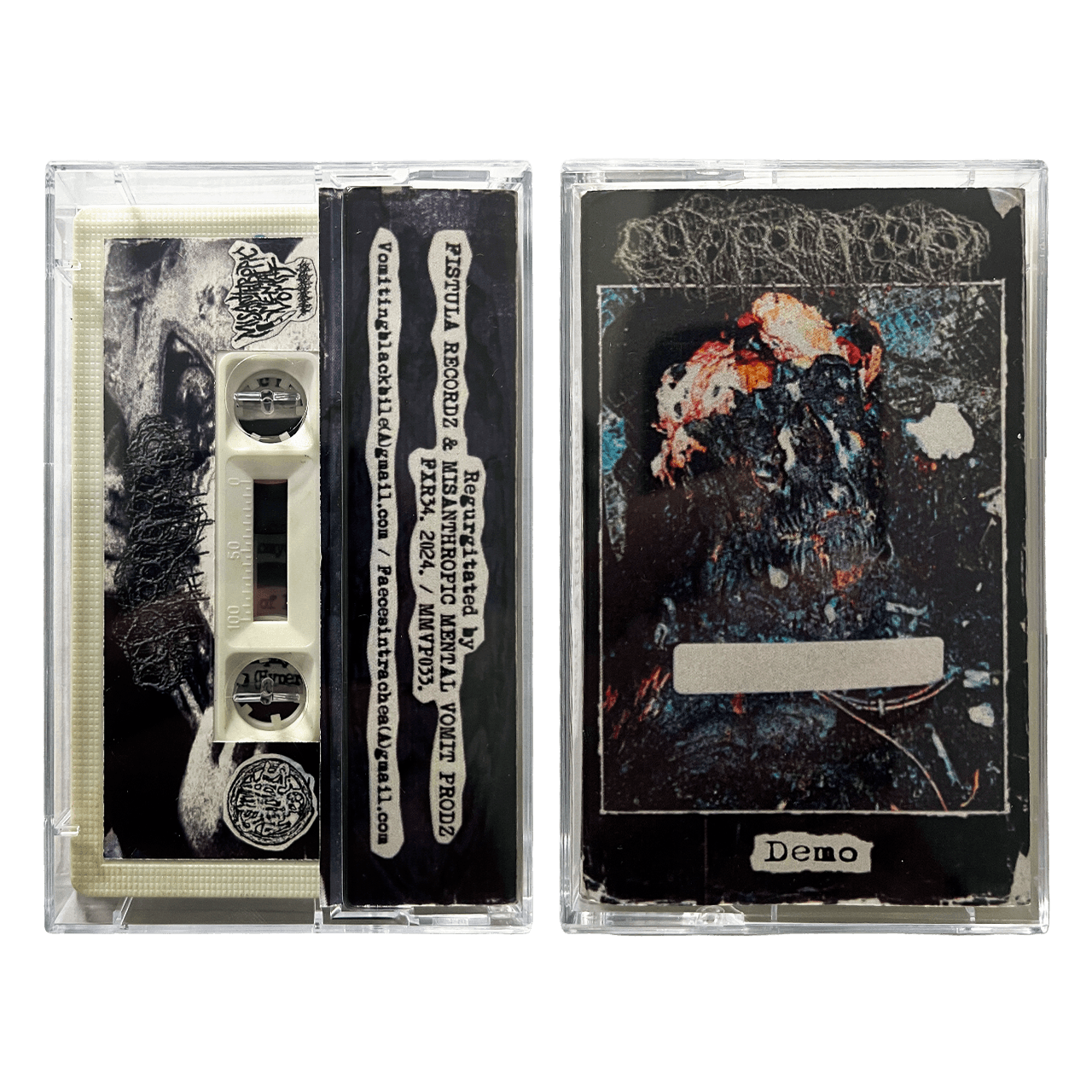 Dextrocardia 'Demo' Cassette