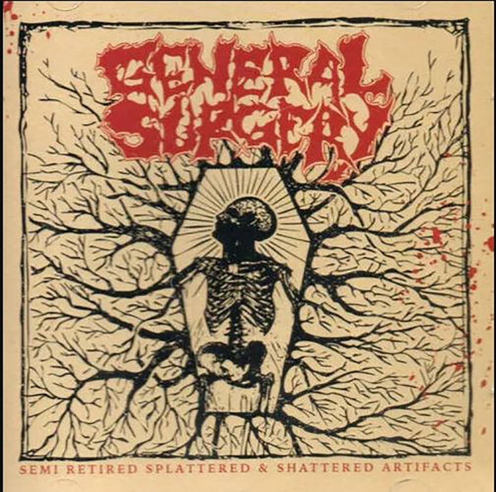 GENERAL SURGERY - Semi Retired Splattered & Shattered Artifacts